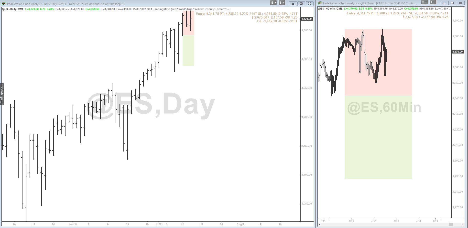Global Setup Screenshot